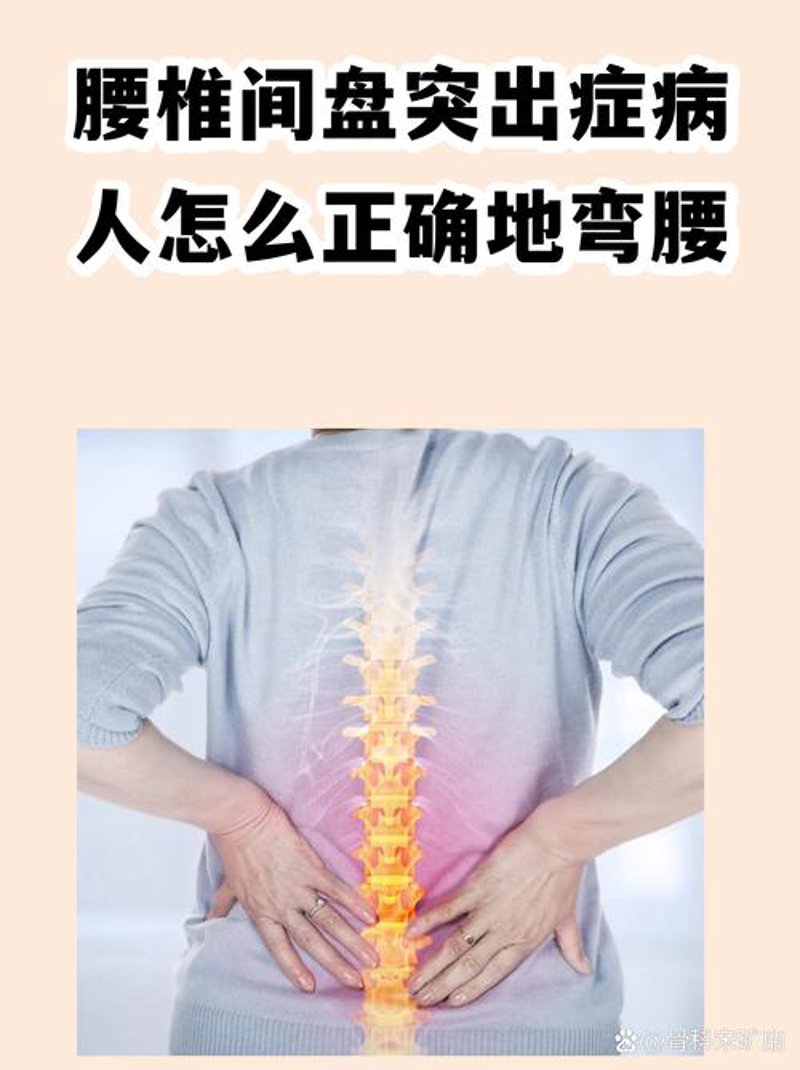 颈椎病:新时代上班族的“隐形杀手”