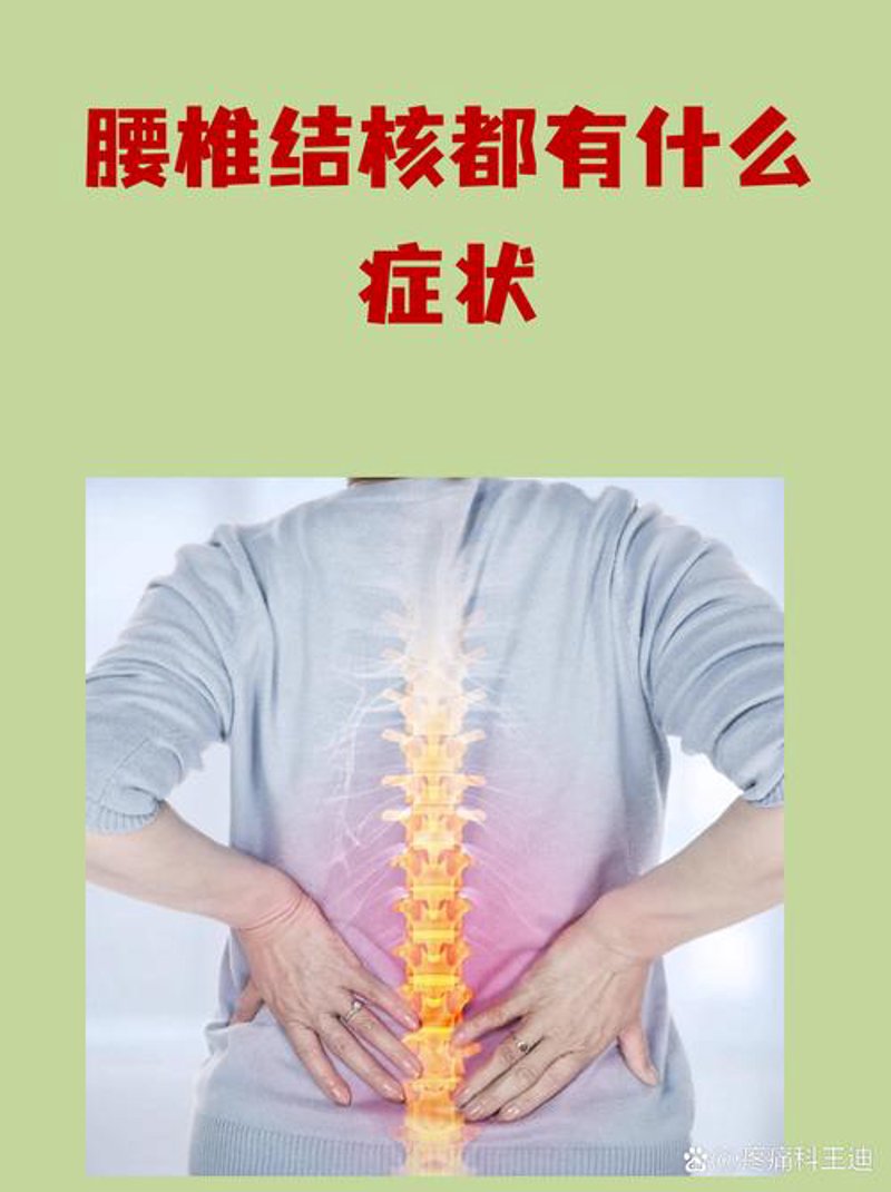 脊椎病在现代职场中的阴影